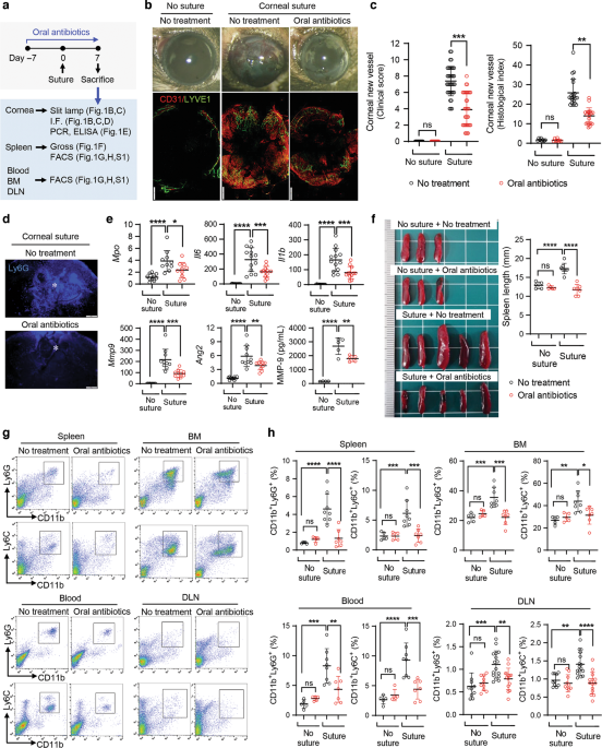 Ocular microbiota promotes pathological angiogenesis and inflammation in sterile injury-driven corneal neovascularization