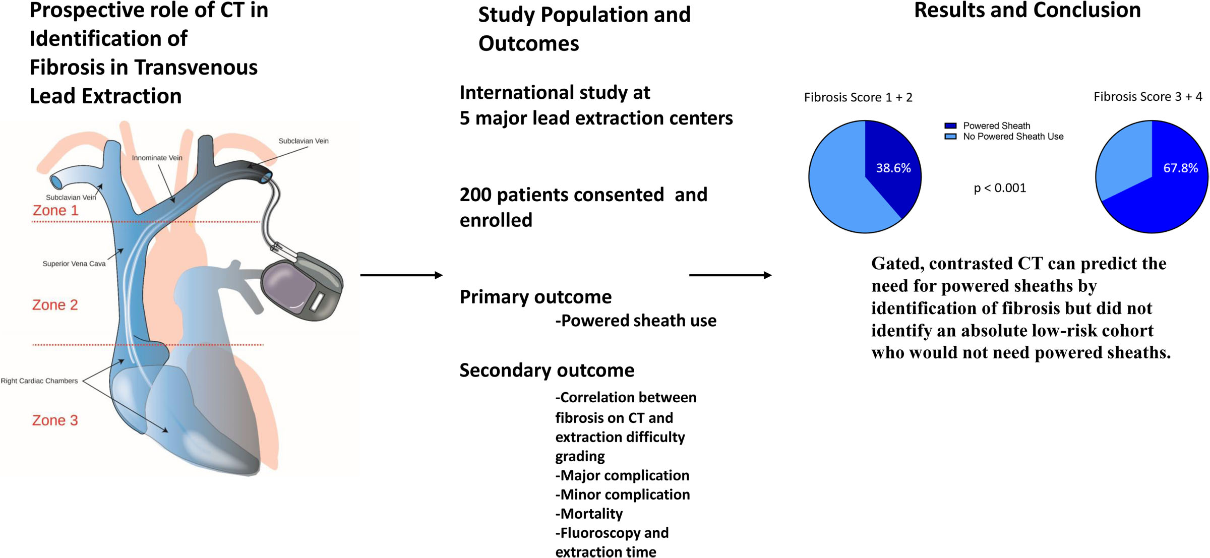 Prospective Evaluation of the Correlation Between Gated Cardiac Computed Tomography Detected Vascular Fibrosis and Ease of Transvenous Lead Extraction