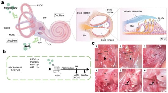 Biomolecules, Vol. 13, Pages 38: Approaches and Vectors for Efficient Cochlear Gene Transfer in Adult Mouse Models