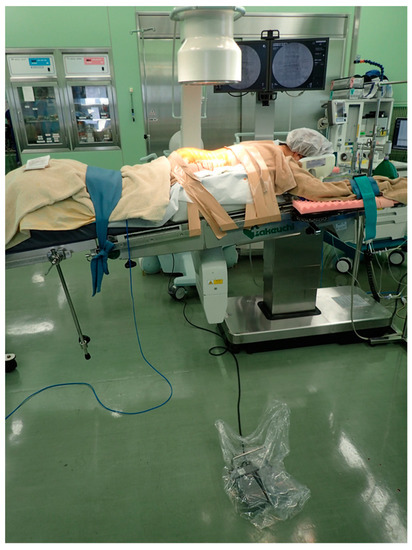 Tomography, Vol. 9, Pages 12-24: Reduction in Radiation Exposure in Minimally Invasive Pedicle Screw Placement Using a Tubular Retractor: A Pilot Study