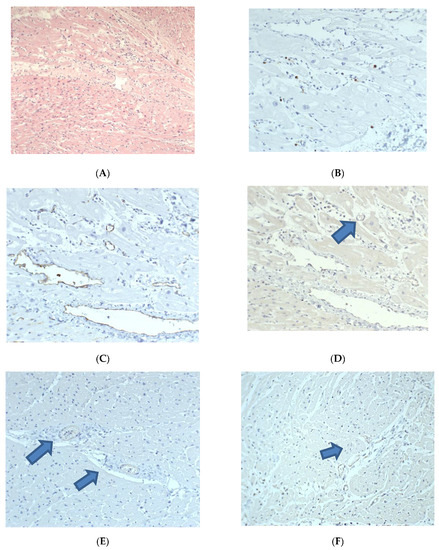 Diagnostics, Vol. 13, Pages 120: Cardiac Involvement in Children Affected by COVID-19: Clinical Features and Diagnosis