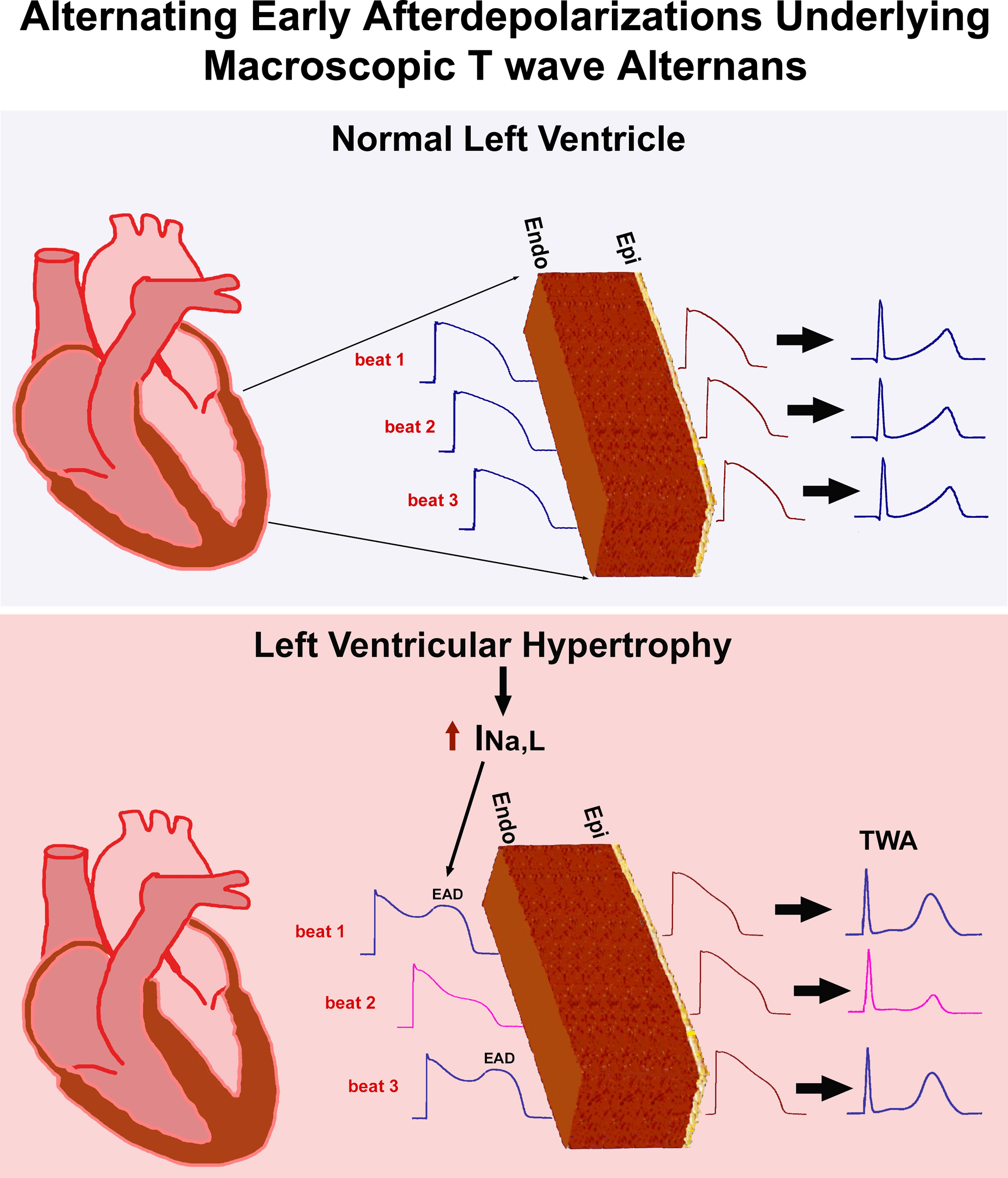 Alternating Early Afterdepolarizations Underlying Bradycardia-Dependent Macroscopic T Wave and Discordant Mechanical Alternans