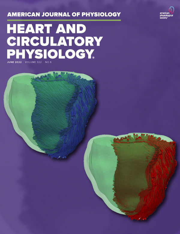 Enhanced protein acetylation initiates fatty acid-mediated inhibition of cardiac glucose transport