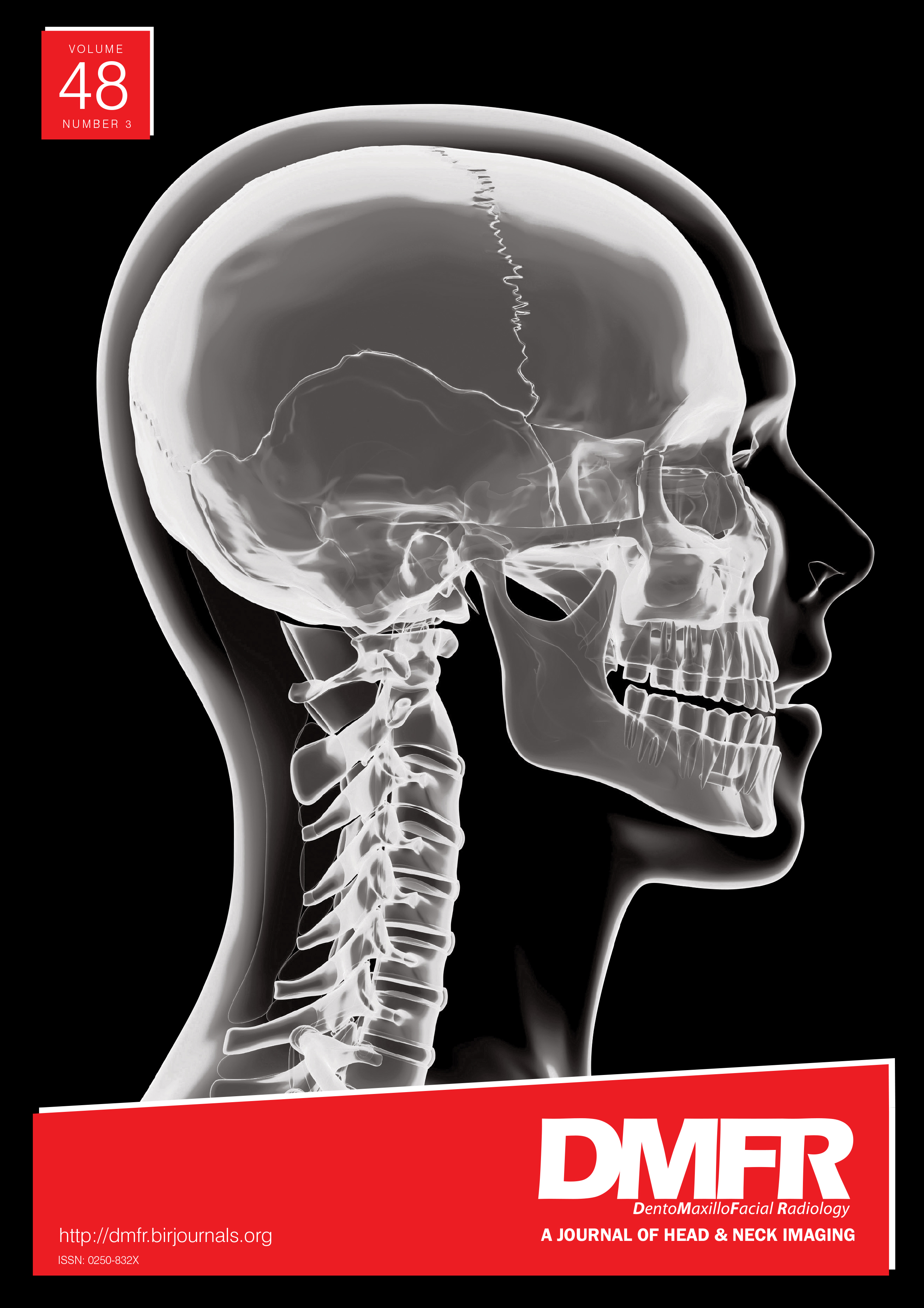 Correlation between the three-dimensional maxillomandibular complex parameters and pharyngeal airway dimensions in different sagittal and vertical malocclusions