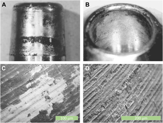 Predicting Corrosion Damage in the Human Body Using Artificial Intelligence