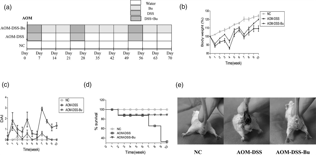 Butyrate ameliorates colorectal cancer through regulating intestinal microecological disorders