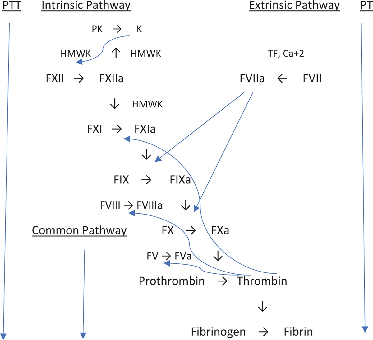 Resolution of cardiac surgical bleeding with the combination of 4-factor prothrombin complex concentrate and fresh frozen plasma following lack of response to fresh frozen plasma alone in a patient with severe factor XI deficiency