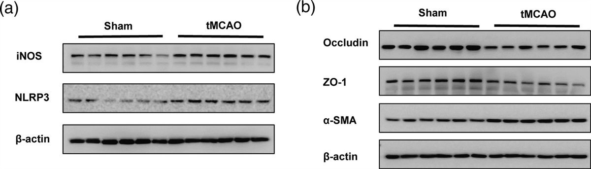 NDUFC2 deficiency exacerbates endothelial mesenchymal transformation during ischemia-reperfusion via NLRP3