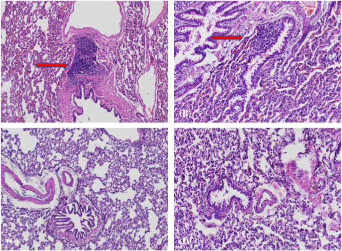 Biodistribution of lentiviral transduced adipose-derived stem cells for “ex-vivo” regional gene therapy for bone repair