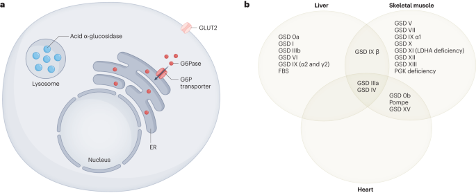 Glycogen storage diseases