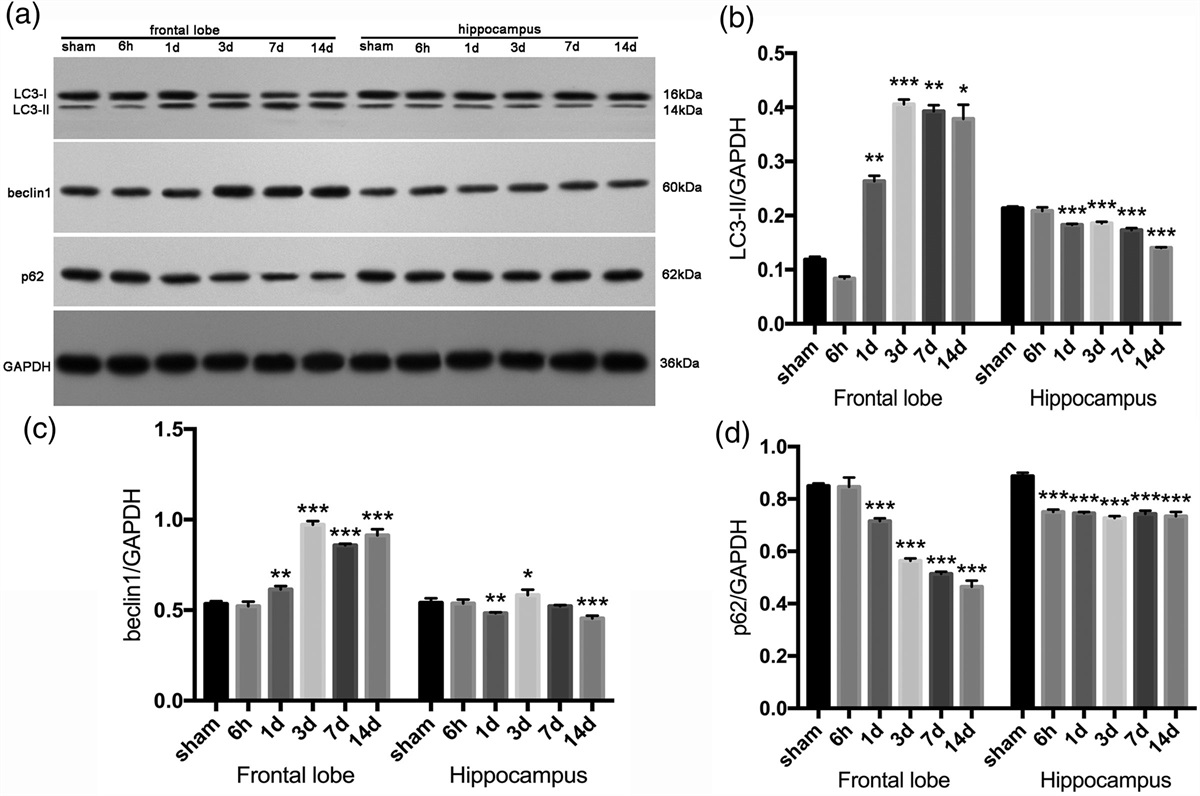 Activation of autophagy after blast-induced traumatic brain injury in mice