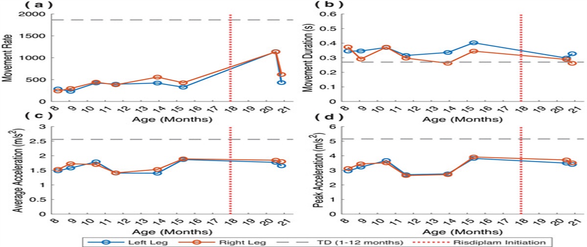 Daily Quantity and Kinematic Characteristics of Leg Movement in a Child With SMA (2 Copies SMN2)