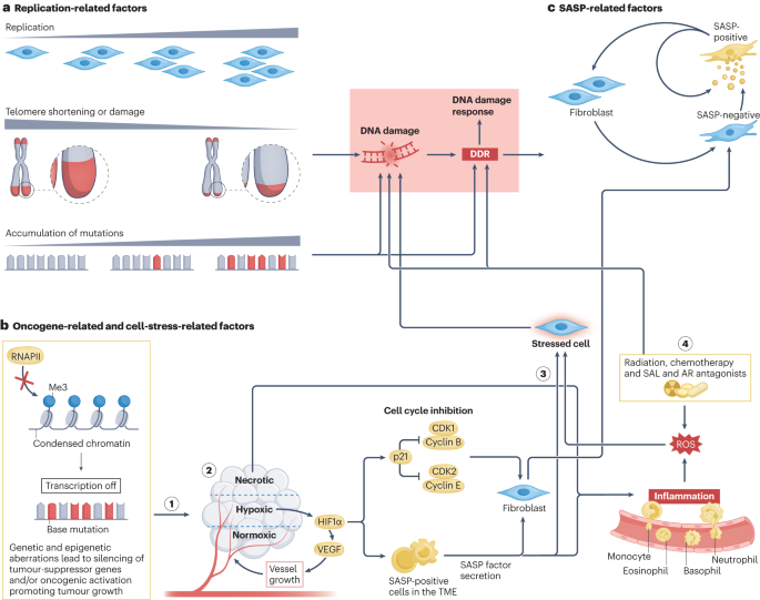 Prognostic and therapeutic potential of senescent stromal fibroblasts in prostate cancer