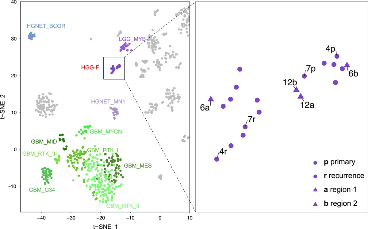 A Novel Type of IDH-wildtype Glioma Characterized by Gliomatosis Cerebri-like Growth Pattern, TERT Promoter Mutation, and Distinct Epigenetic Profile