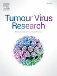 Interplay between the DNA damage response and the life cycle of DNA tumor viruses