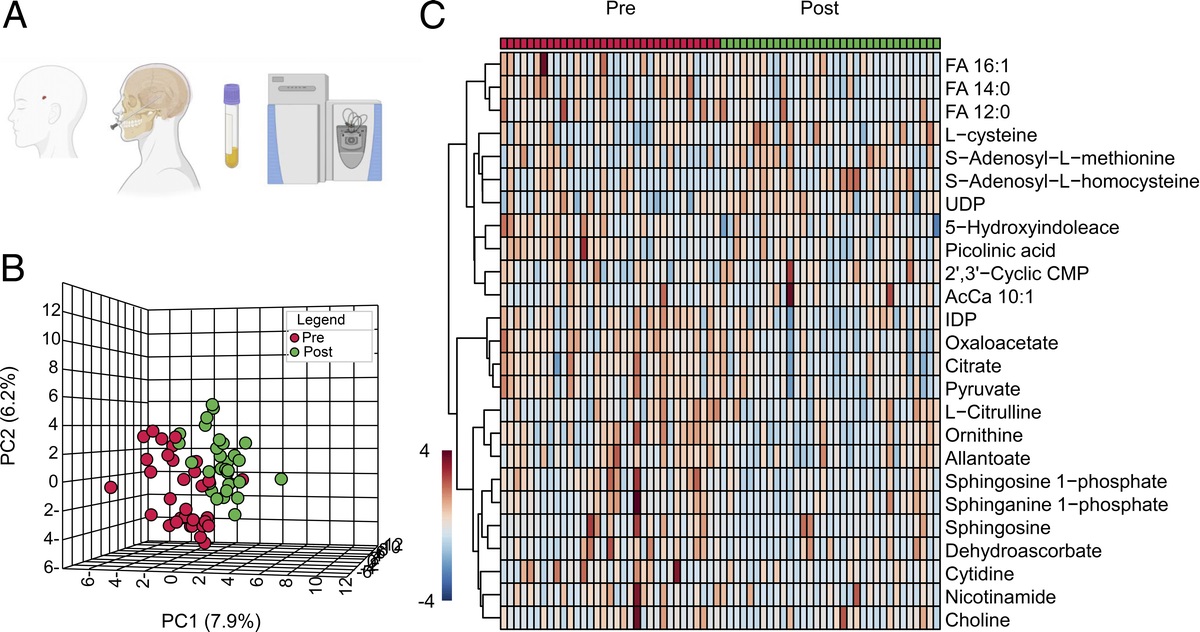 A metabolomic and proteomic analysis of pathologic hypercoagulability in traumatic brain injury patients after dura violation