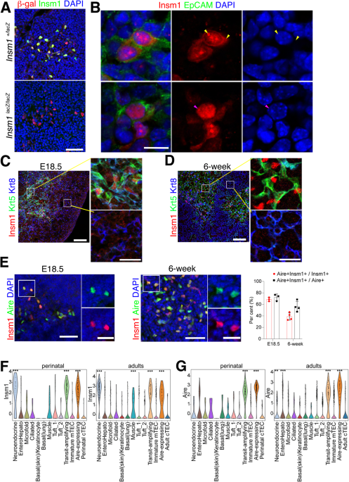 Insm1 regulates mTEC development and immune tolerance