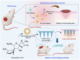 Purpurolide C-based microneedle promotes macrophage-mediated diabetic wound healing via inhibiting TLR4-MD2 dimerization and MYD88 phosphorylation