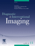 A simple coronary CT angiography-based jeopardy score for the identification of extensive coronary artery disease: Validation against invasive coronary angiography