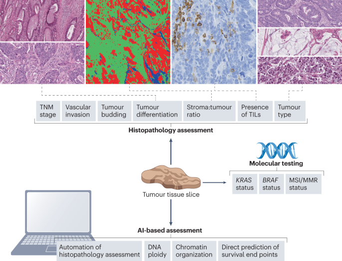 Personalizing adjuvant therapy for patients with colorectal cancer