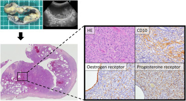 Highly malignant endometrial stromal sarcoma in a cat